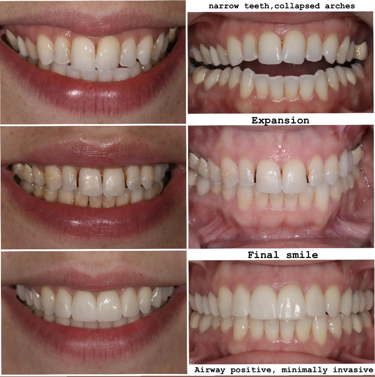 A+BCDE Protocol patient example image 1