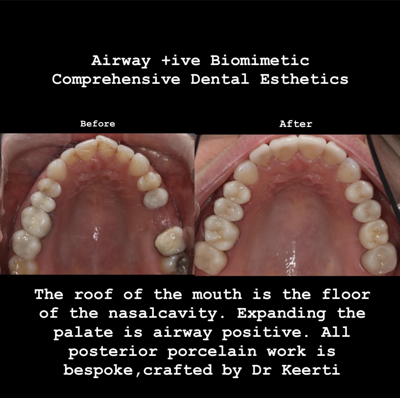 A+BCDE Protocol patient example image 2