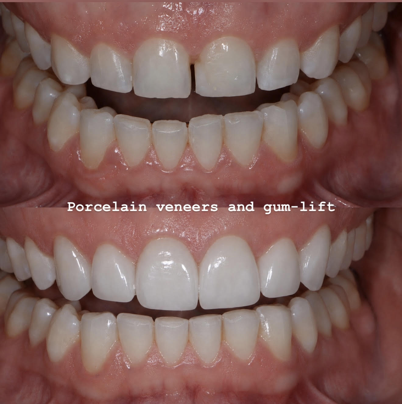 Case 1 image 1