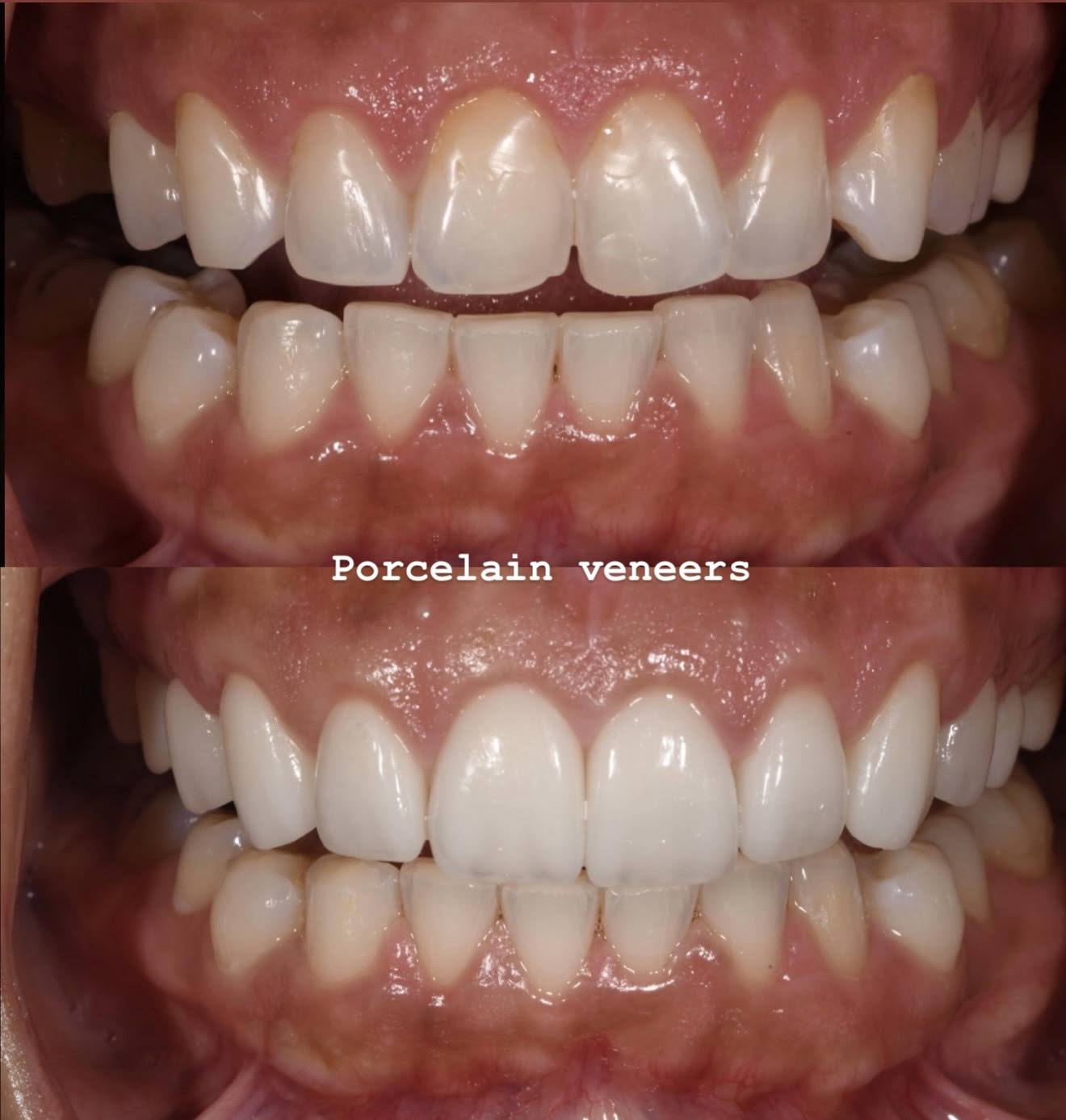 Case 2 image 2