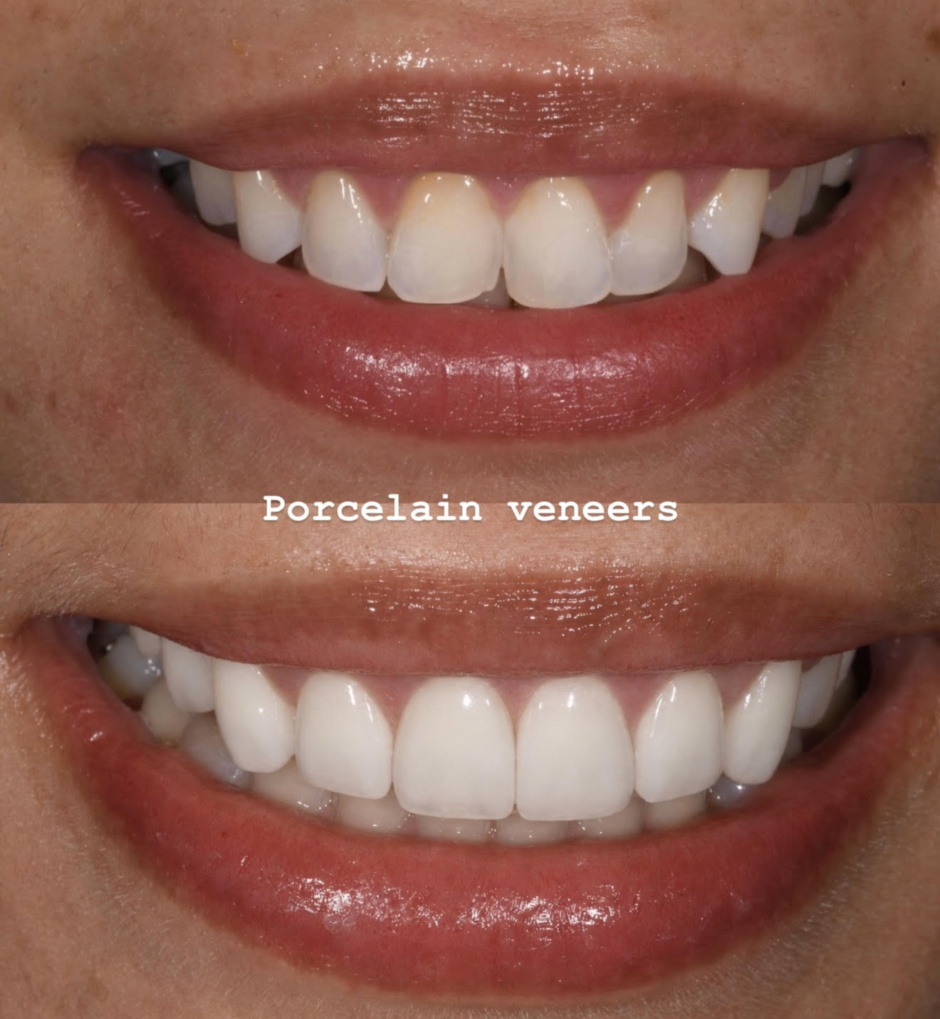 Case 2 image 1
