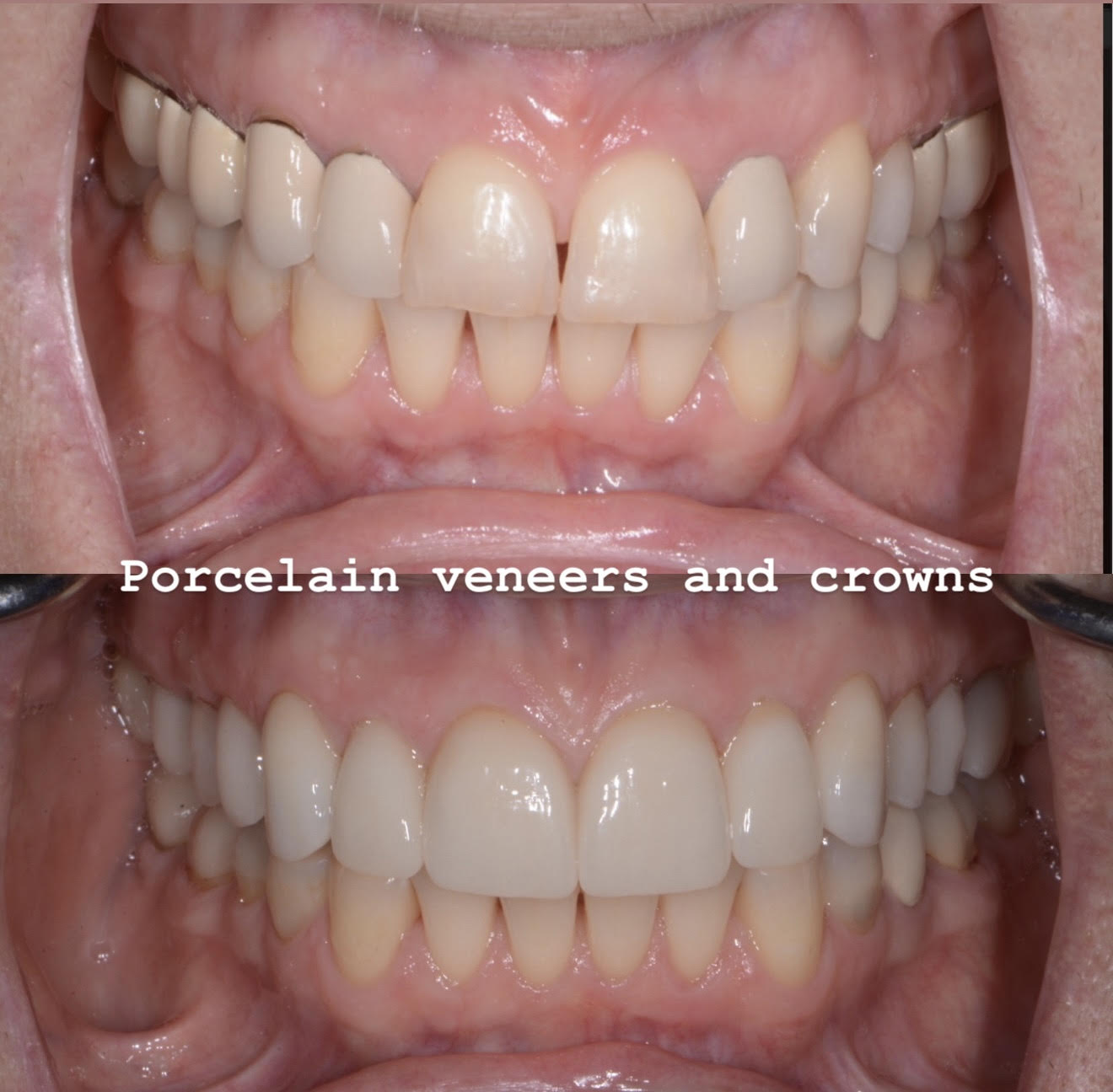 Case 3 image 1
